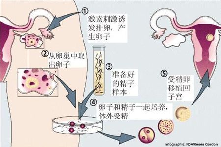 陈教授